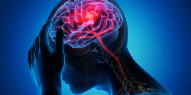 AVC : certains groupes sanguins plus exposés selon une étude